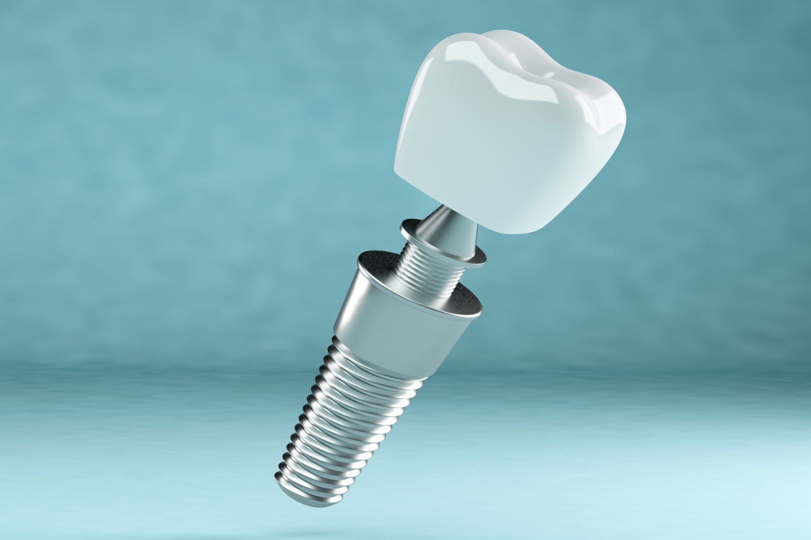 Implante Dentario e Definitivo